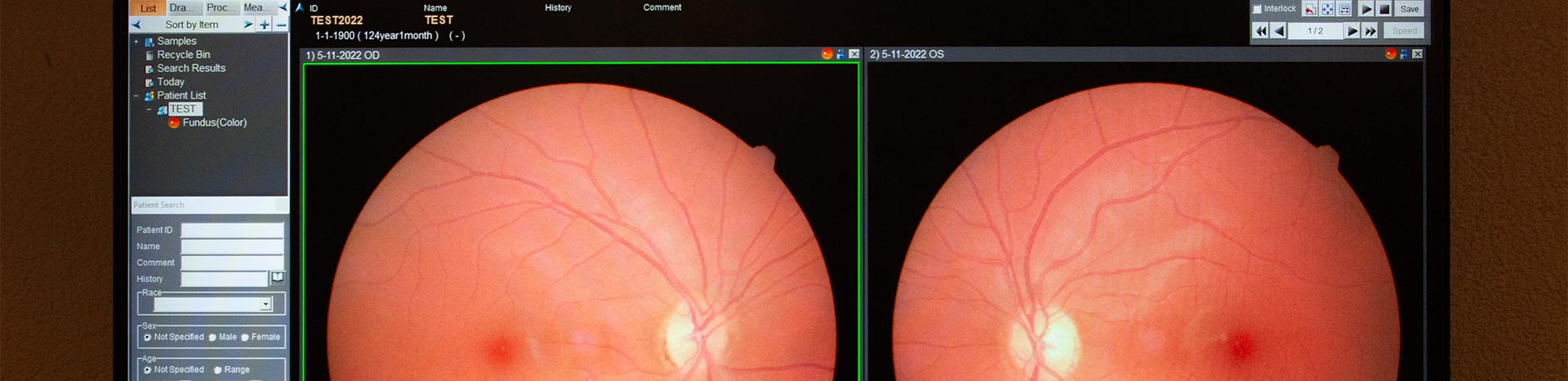 jpcoptiek-oogzorg-optometrie-1
